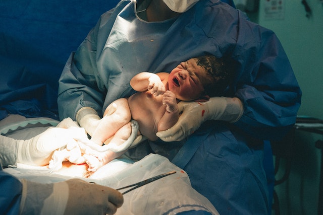 Noworodek wyjęty z brzucha mamy podczas cesarskiego cięcia